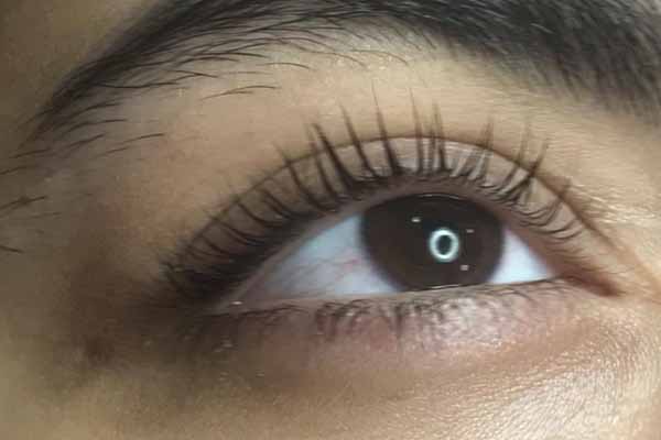 elazığ- Kirpik lifting