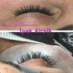 Elazığ Güzellik Kaş Alımı